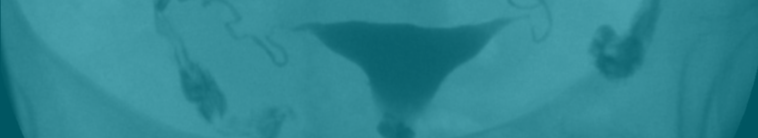 banner img